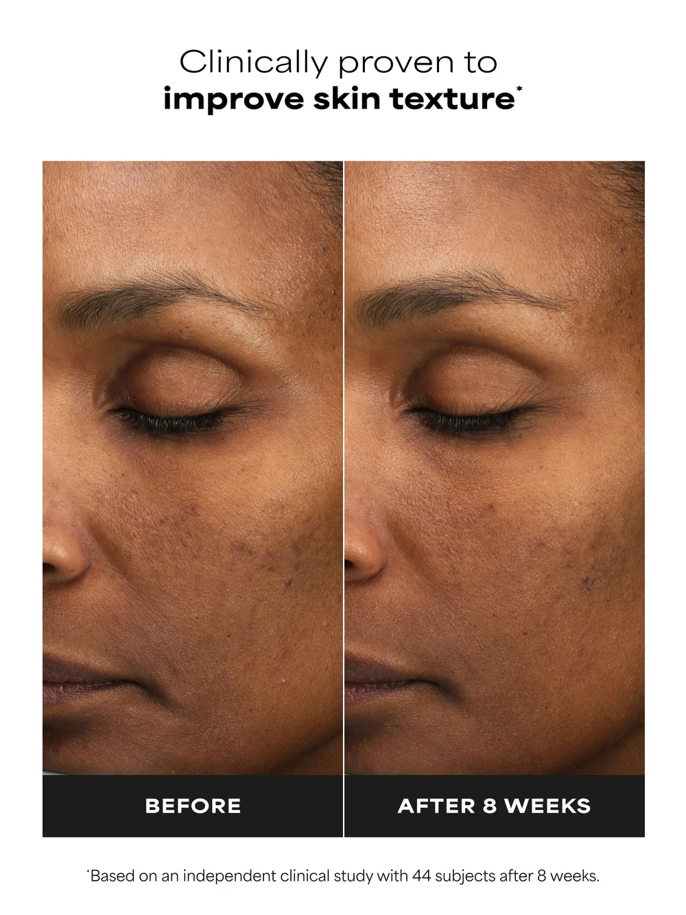 SKIN PERFECTING 6% Mandelic Acid + 2% Lactic Acid Liquid Exfoliant - Image 3