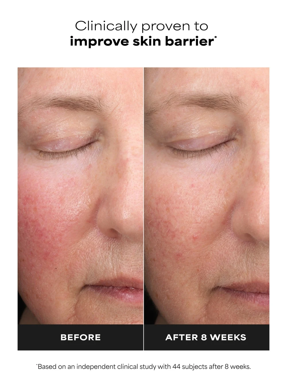 SKIN PERFECTING 6% Mandelic Acid + 2% Lactic Acid Liquid Exfoliant - Image 4