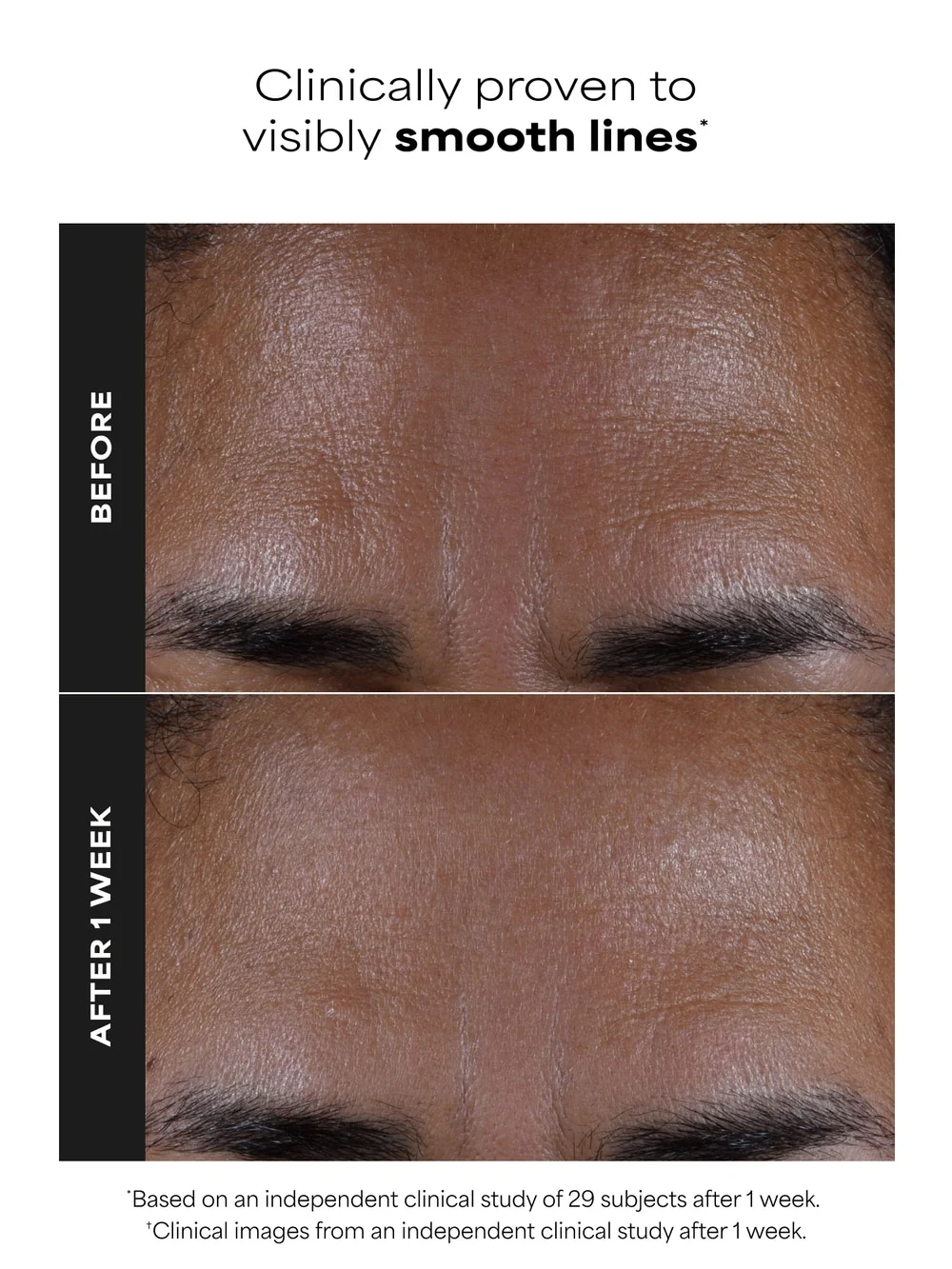 2% BHA Liquid Exfoliant - Image 3