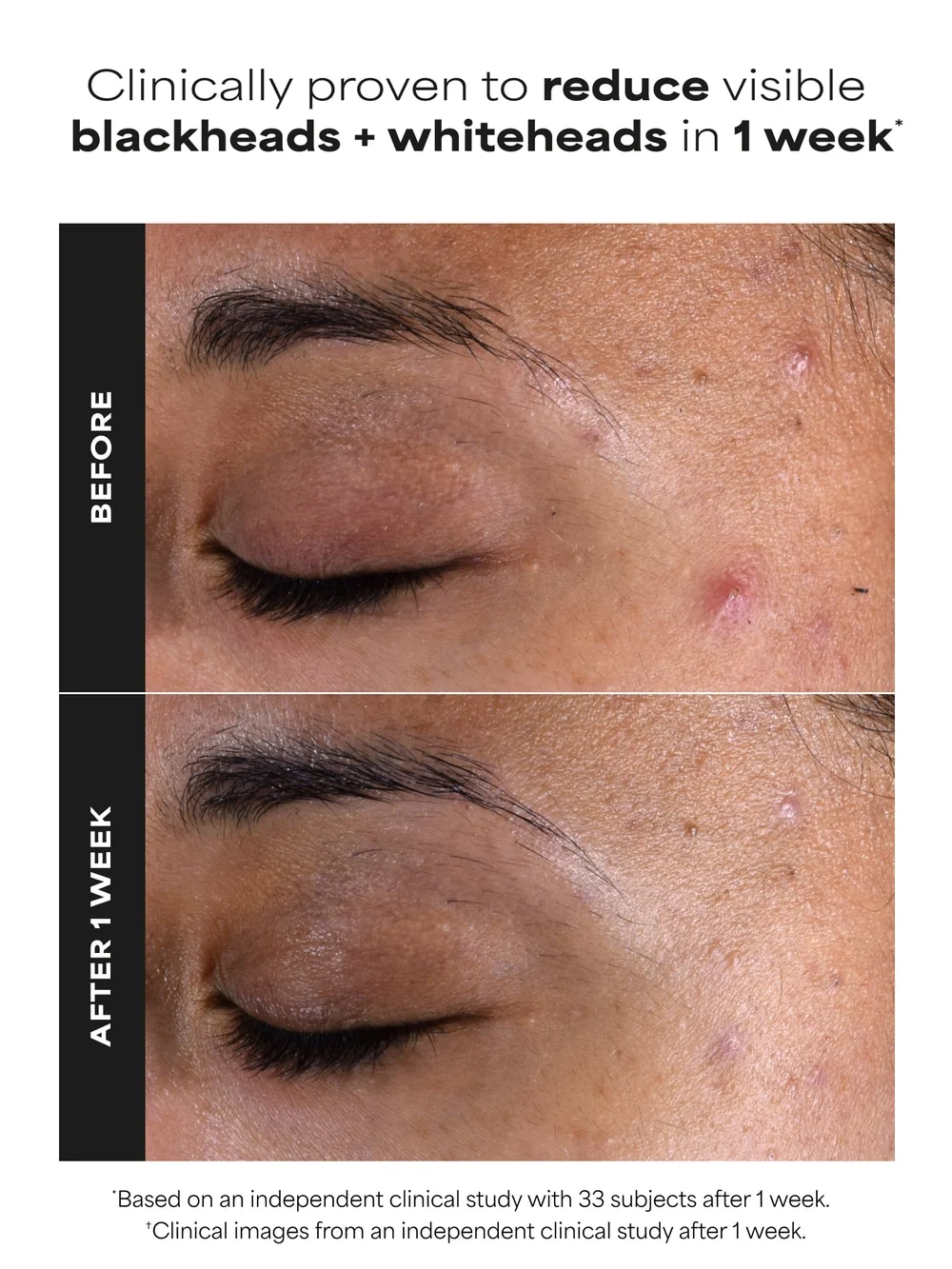 2% BHA Liquid Exfoliant - Image 4