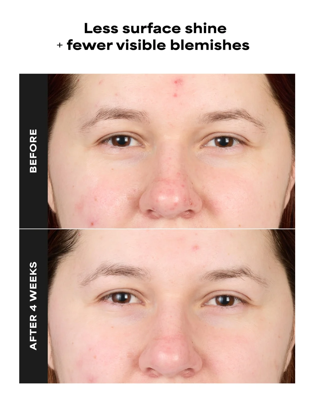 SKIN PERFECTING 4% BHA Advanced Exfoliating Serum Toner - Image 2