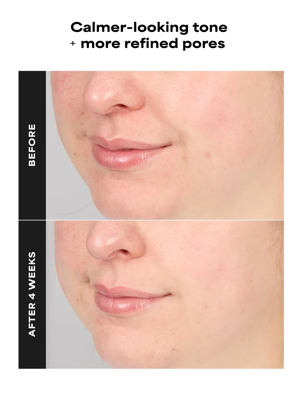SKIN PERFECTING 4% BHA Advanced Exfoliating Serum Toner - Image 3