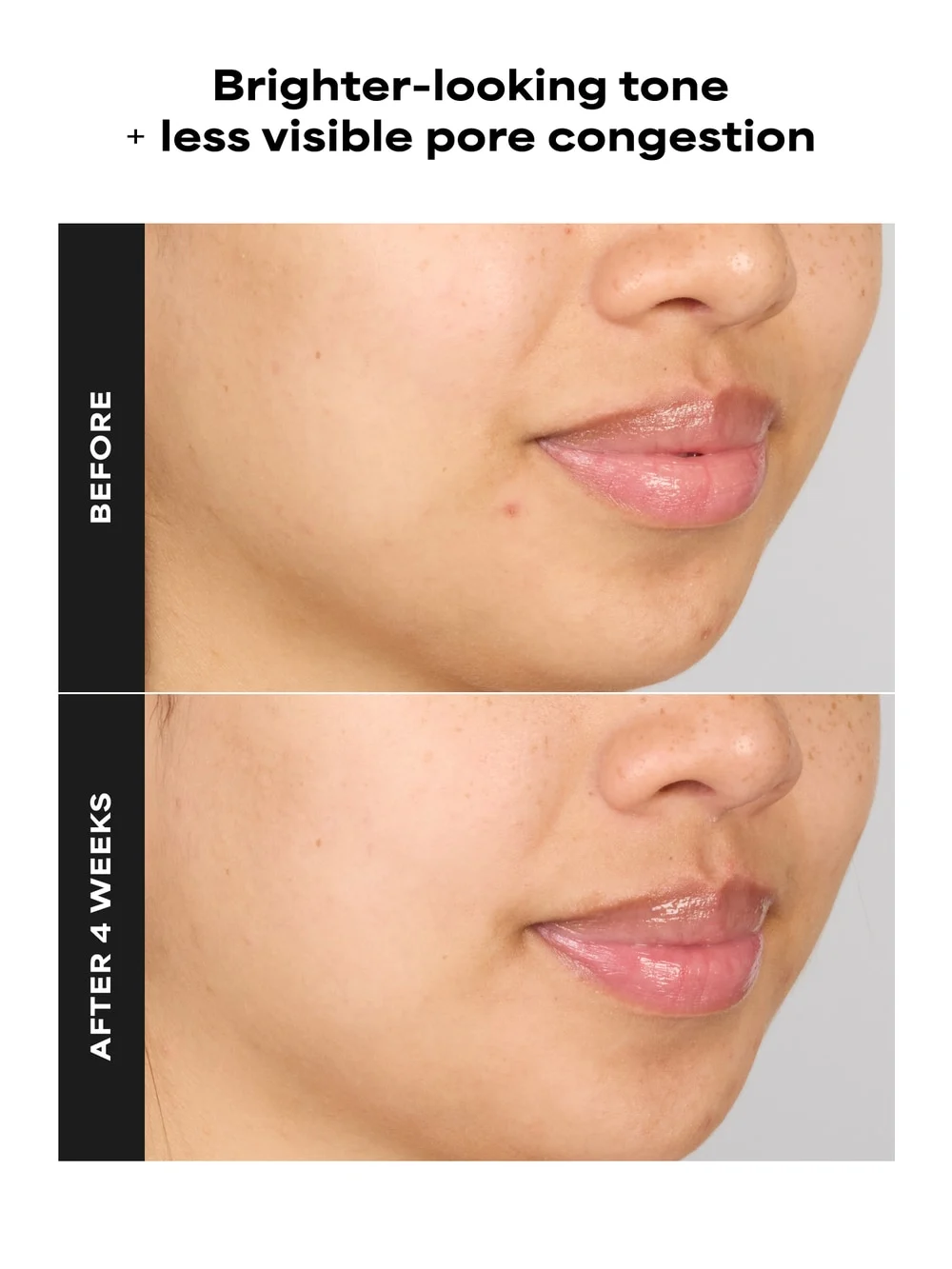 SKIN PERFECTING 4% BHA Advanced Exfoliating Serum Toner - Image 4